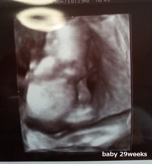 29weeks ultrasounds