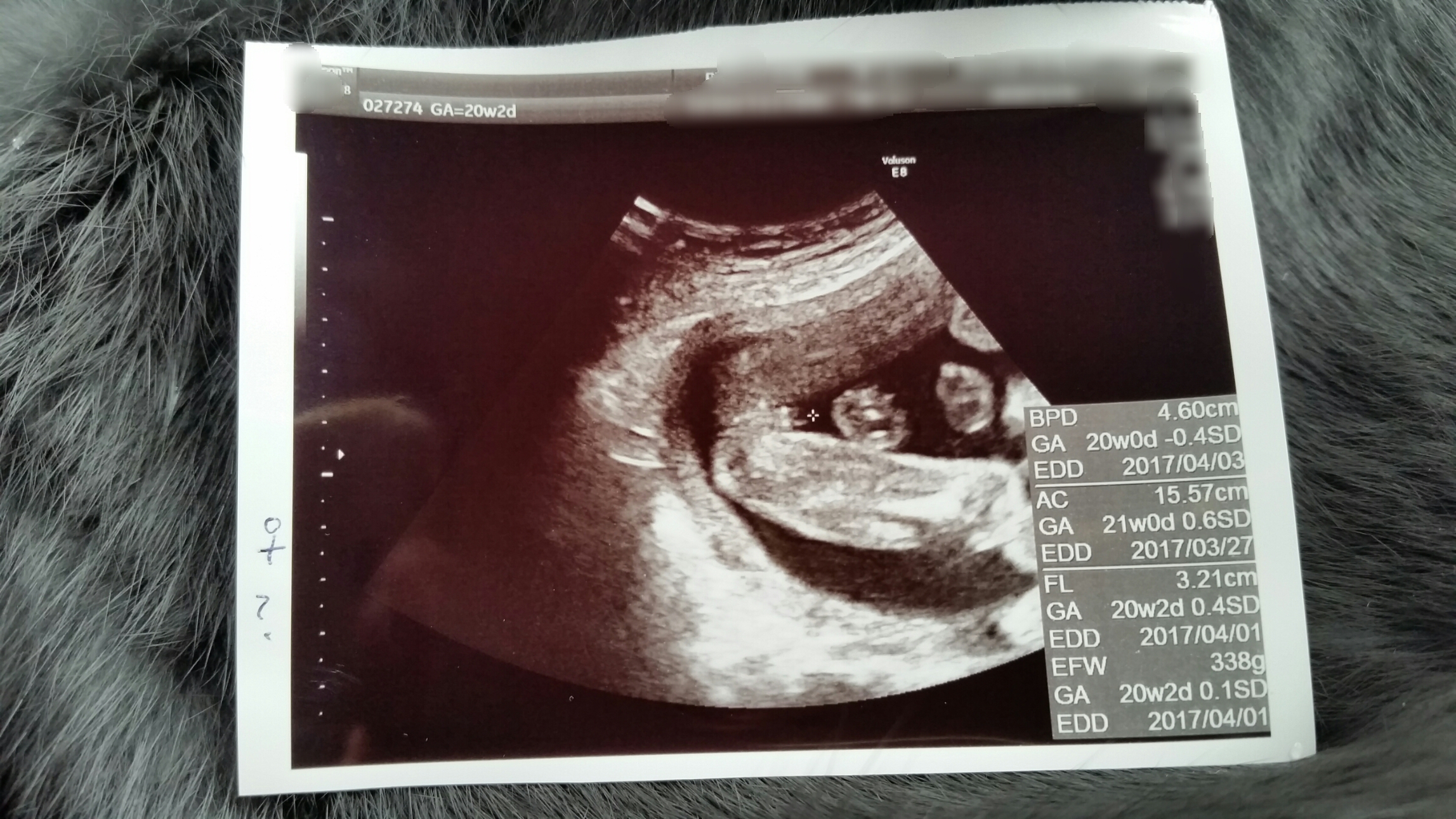 妊娠６ヶ月で性別判定出た エコー写真で見る女の子の図 Mamaにゃ ごの育児生活ブログ
